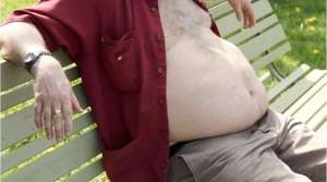 Obesity Obesity